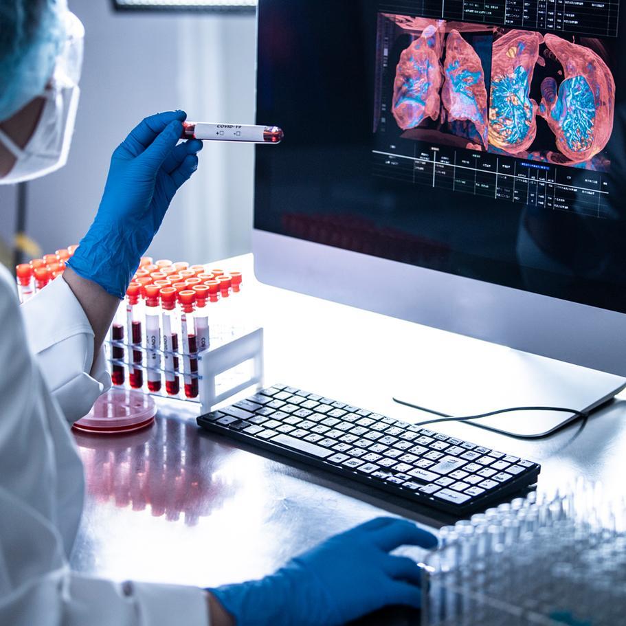 A scientist examines a test tube vial while working on a computer